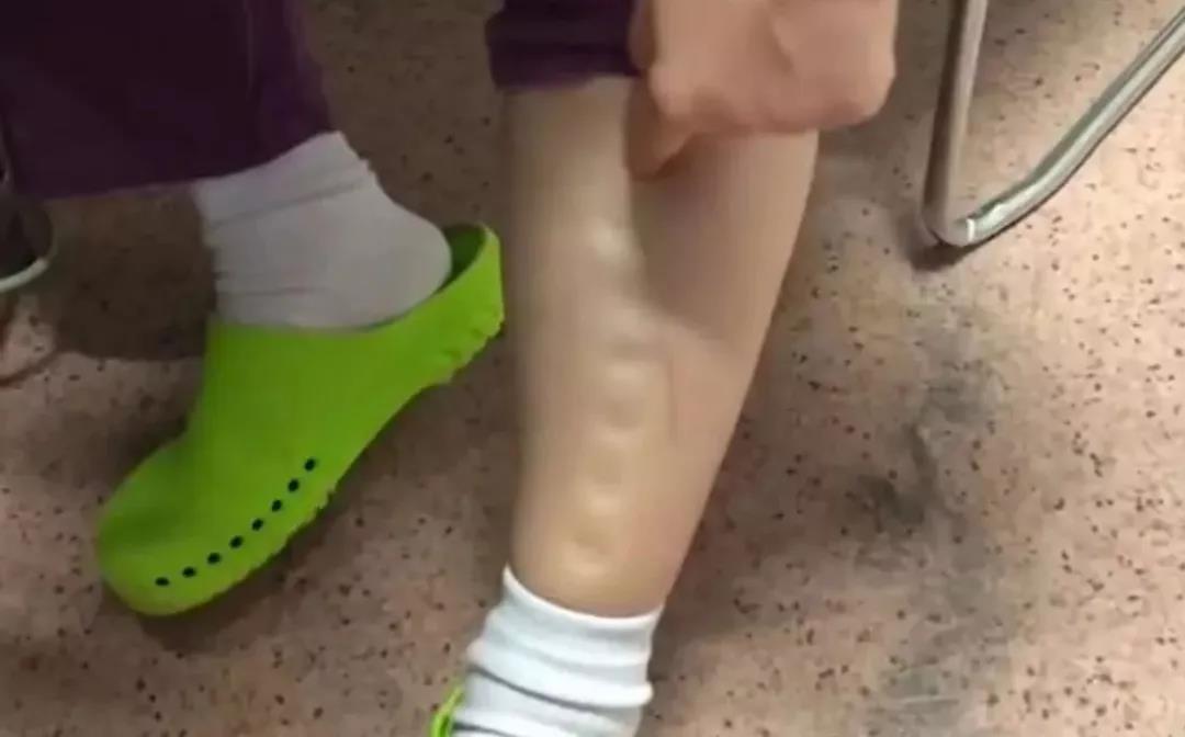 孕期体重管理(图4) 孕期体重管理(图4)
