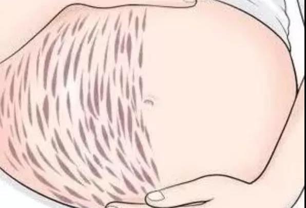 孕期体重管理(图2) 孕期体重管理(图2)